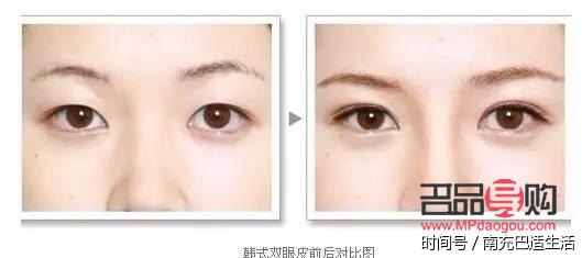 雙眼皮有幾種眼型照片圖片女(雙眼皮有幾種眼型照片圖片女生)