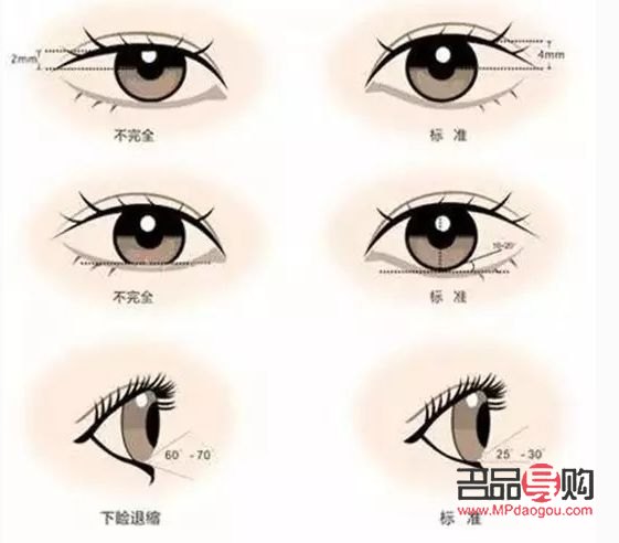 開眼角與不開眼角的區別(開眼角與不開眼角的區別圖)