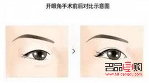 開眼角與不開眼角的區別(開眼角與不開眼角的區別圖)