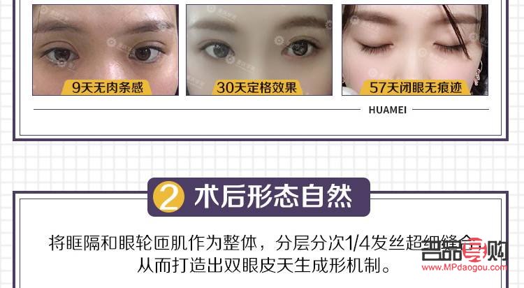 翹睫雙眼皮是永久的嗎怎么做(翹睫雙眼皮是永久的嗎怎么做手術)
