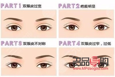 雙眼皮：寬與窄，哪一種更具魅力？