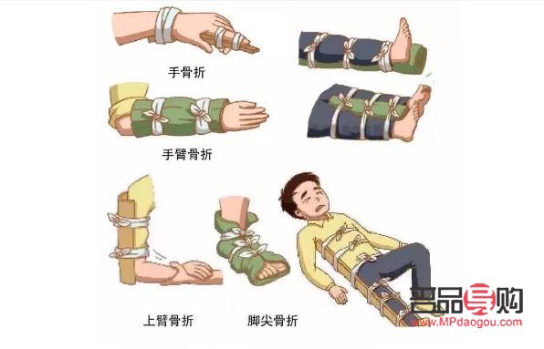 骨折后如何科學(xué)護(hù)理身體