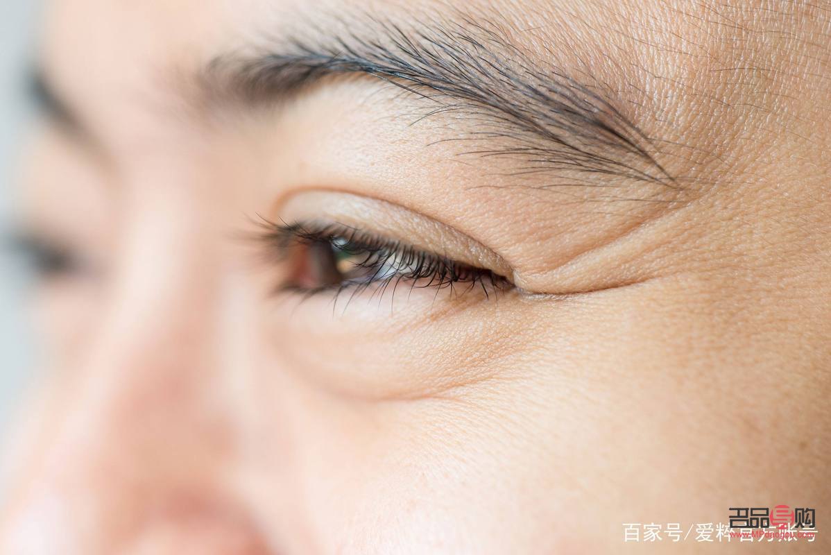 眼角睡覺壓的皺紋能去掉嗎(去皺紋最快的土辦法)
