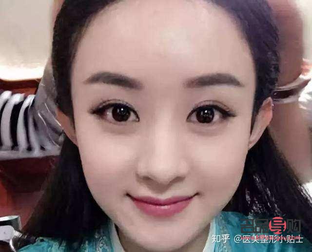 新月型雙眼皮真人圖片女孩(新月型雙眼皮真人圖片女孩可愛)
