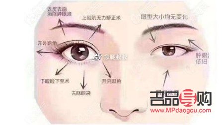 小眼綜合四項都包括什么(小眼綜合四項都包括什么內容)