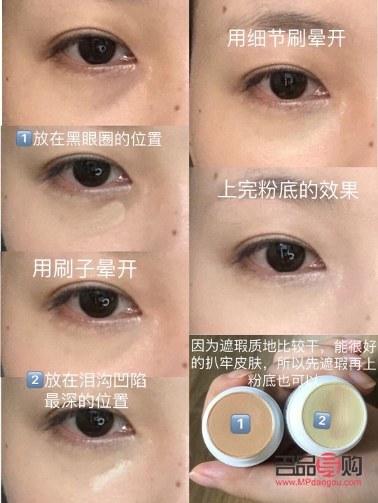 眼睛凹下去了怎么補救