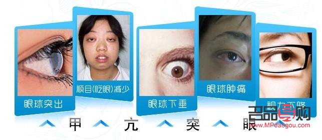 甲亢突眼能做手術(shù)嗎(甲亢突眼能做手術(shù)嗎?)