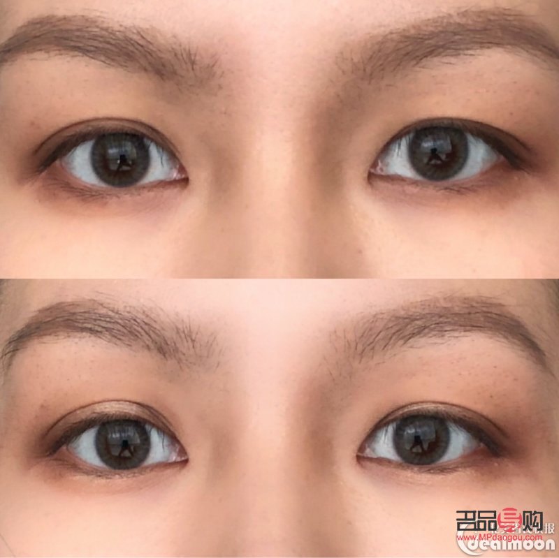 <h3>內雙腫眼泡的消除秘訣</h3>