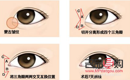 眼角下垂有什么辦法可以調(diào)整的(眼角下垂有什么辦法可以調(diào)整的小孩)