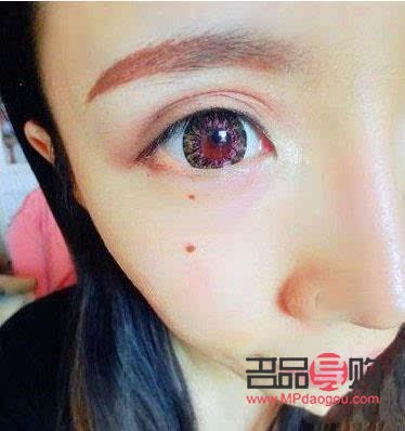 女人長痣怎么美容