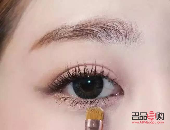 上眼皮抽脂消腫全攻略：了解恢復過程，快速告別腫脹困擾