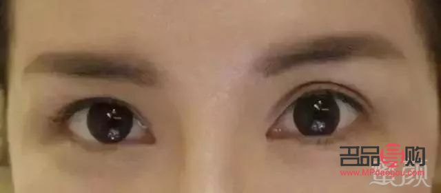 春秋兩季，雙眼皮成形的最佳時機
