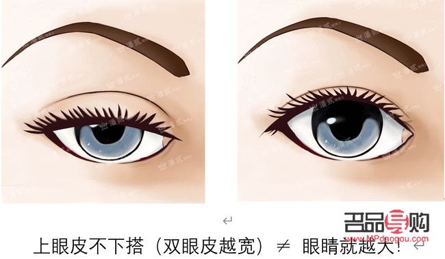 上眼皮松弛恢復鍛煉法(上眼皮松弛恢復鍛煉法圖片)