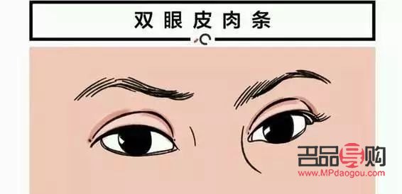 割雙眼皮和自然雙眼皮的區別圖片(割雙眼皮和自然雙眼皮的區別圖片大全)
