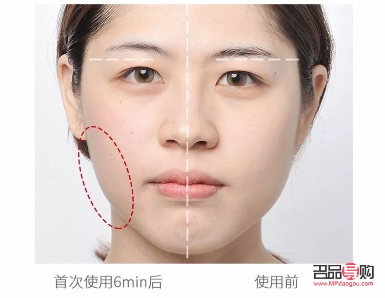 雅萌哪款美容儀好(雅萌哪款美容儀好用)