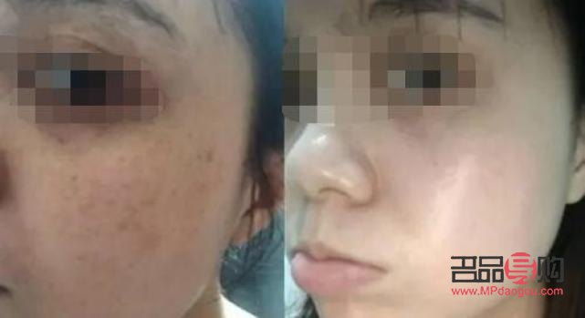 哪家美容效果好(哪家美容效果好點)