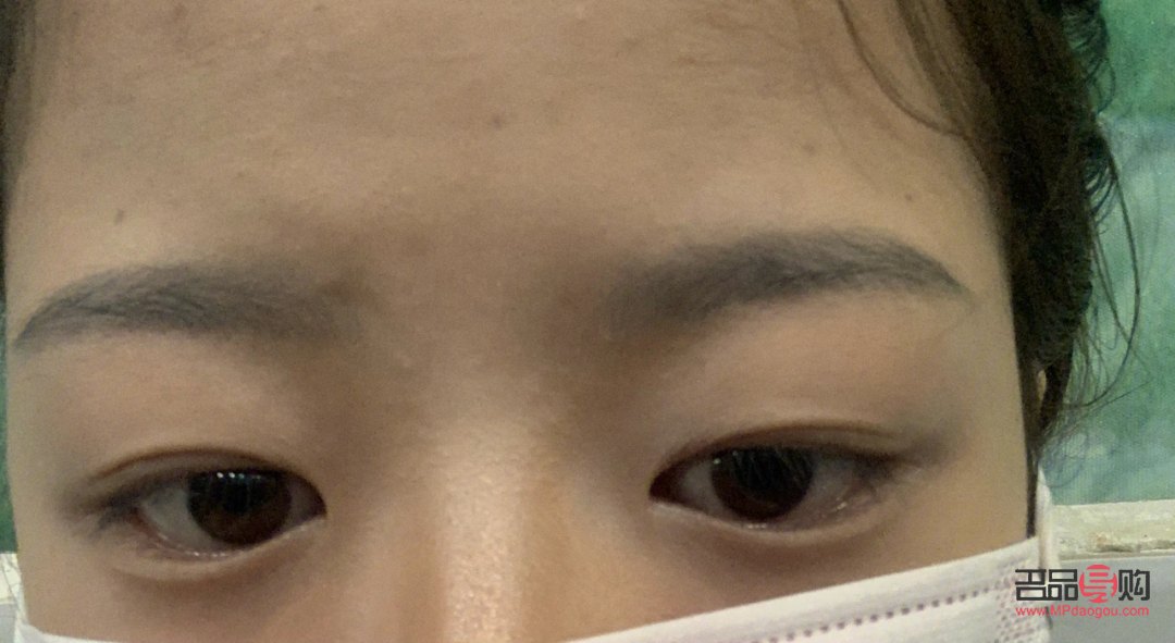 <h3>腫眼泡是怎么回事？</h3>