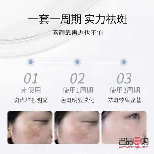 <h3>美容院祛斑全攻略：專業(yè)、安全、高效</h3>