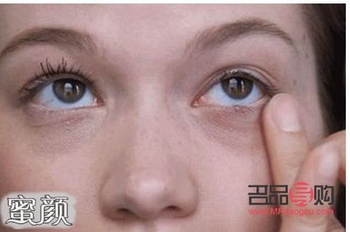 安全有效除眼袋，這些方法值得一試