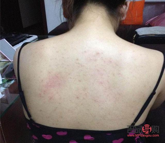 身體乳涂抹技巧與后背護(hù)理全攻略