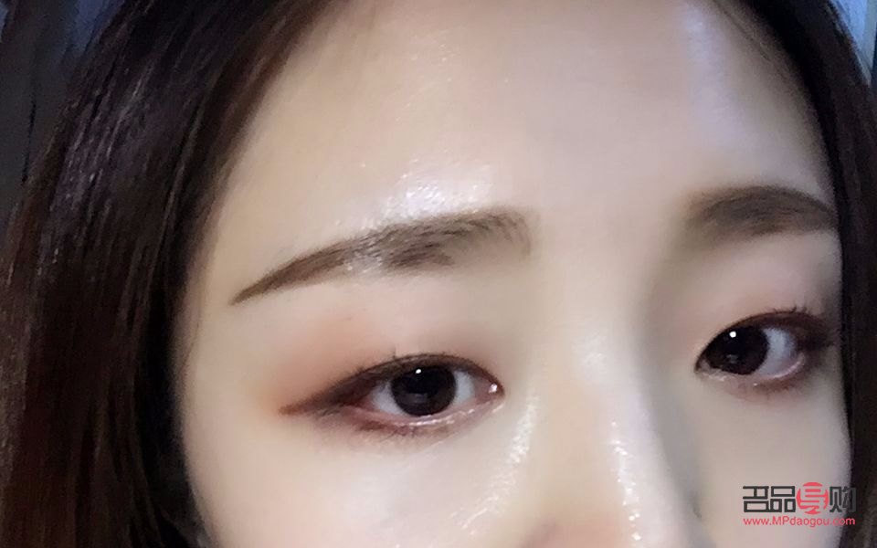 提拉眼皮術(shù)后多久恢復(fù)(提拉眼皮術(shù)后多久恢復(fù)自然)