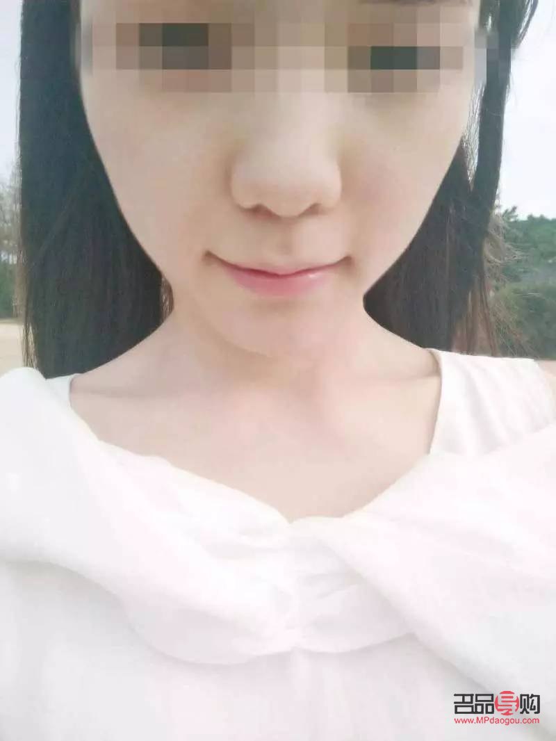打臉能美容嗎(打臉能美容嗎女生)
