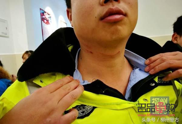 嬰兒抓傷身體怎么護理(嬰兒抓傷留下的印子好久能好)