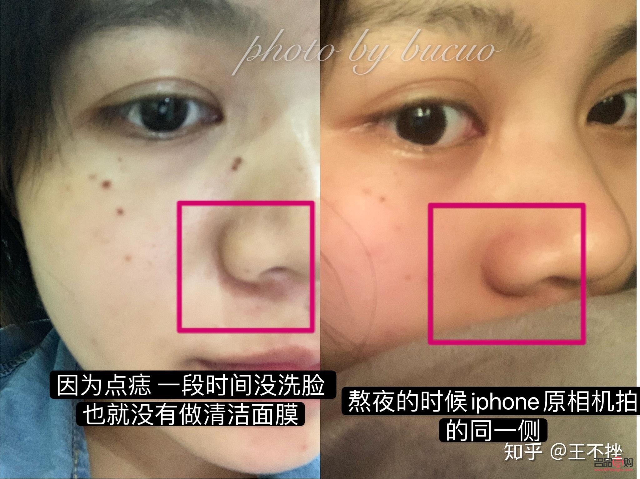 美容院點痣怎么點(美容院點痣怎么點的)