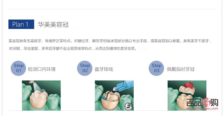 美容冠怎么樣(美容冠怎么樣好看)