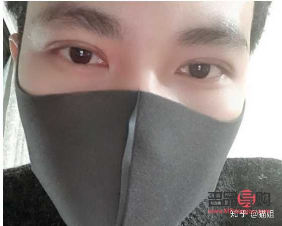 男人是否應該割雙眼皮？探討男性雙眼皮手術的利與弊