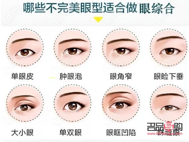 現(xiàn)在流行什么雙眼皮技術(shù)(現(xiàn)在流行什么雙眼皮技術(shù)呢)