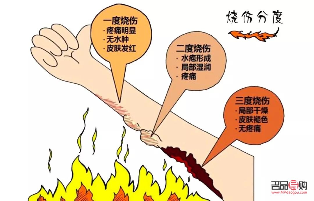 身體燙傷怎么護理好(身上燙傷)