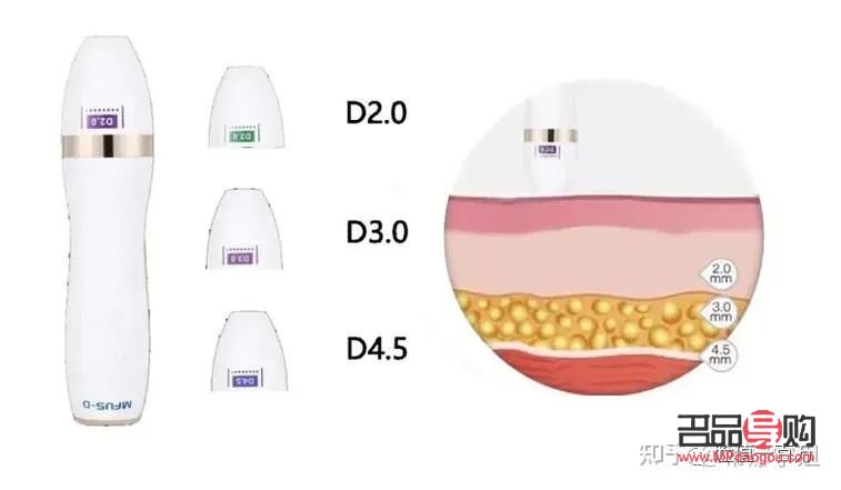 眼部超聲炮：重塑青春明眸，價(jià)格與價(jià)值并存