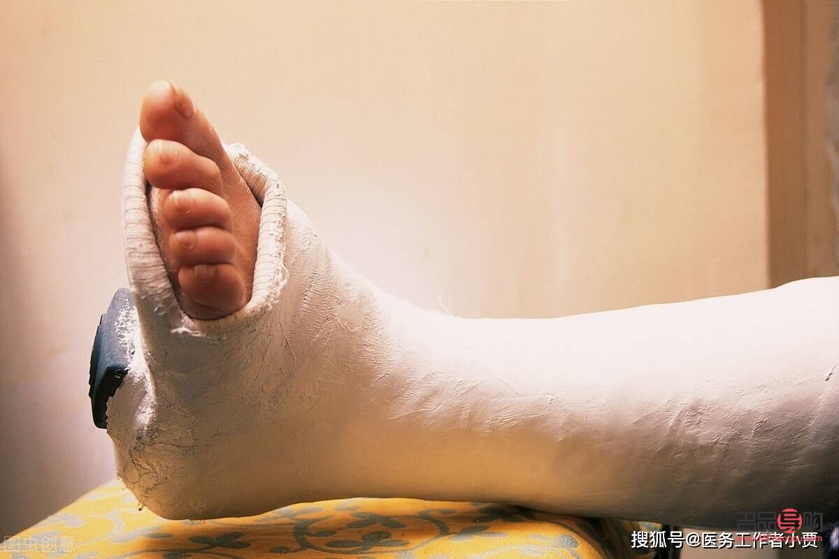 腳骨折能做身體護理嗎(腳骨折能做身體護理嗎視頻)