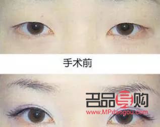 一單一雙眼皮的男生面相解析
