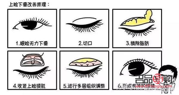 眼綜合七項包括哪些(眼綜合7項)