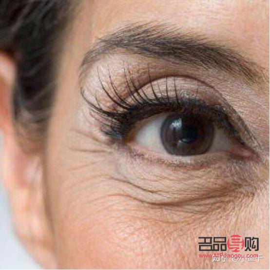 眼部干紋和細紋區別圖(眼部干紋和細紋區別圖片)