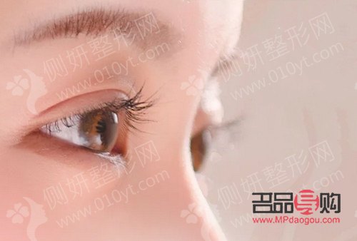 眼睛手術恢復正常的時長探究