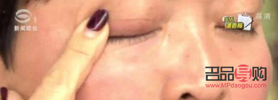 <h3>天生大小眼問題解析：女生是否能進行矯正？</h3>