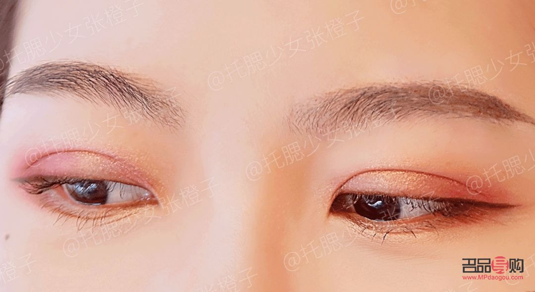 <h3>雙眼皮手術(shù)價格種類全解析</h3>