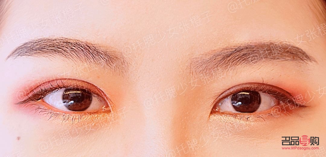<h3>雙眼皮手術(shù)價格種類全解析</h3>