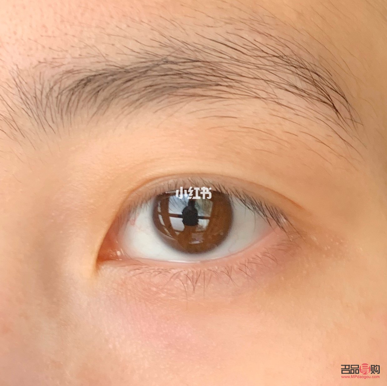 三眼皮怎么變回雙眼皮(三眼皮怎么變回雙眼皮學生)