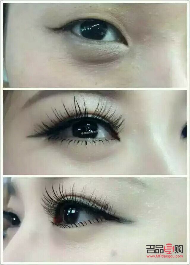 <h3>單眼皮學生如何自然變雙眼皮</h3>