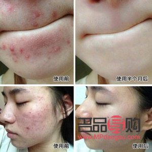 豆豆身體護理怎么做(豆豆身體護理怎么做視頻)