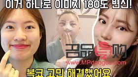 探索女性雙眼皮之美：哪款雙眼皮最受歡迎？