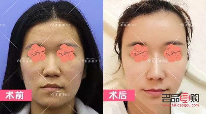 <h3>雅熙身體護理體驗分享</h3>