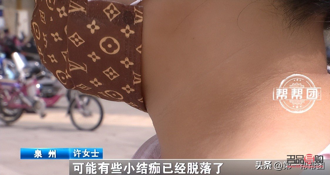 美容會痛嗎？解析美容過程中的疼痛感受