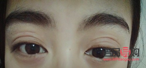 三眼皮(三眼皮怎么恢復(fù)雙眼皮)