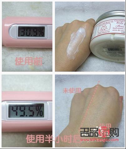 身體火燒怎么護理(身體火燒怎么護理最好)