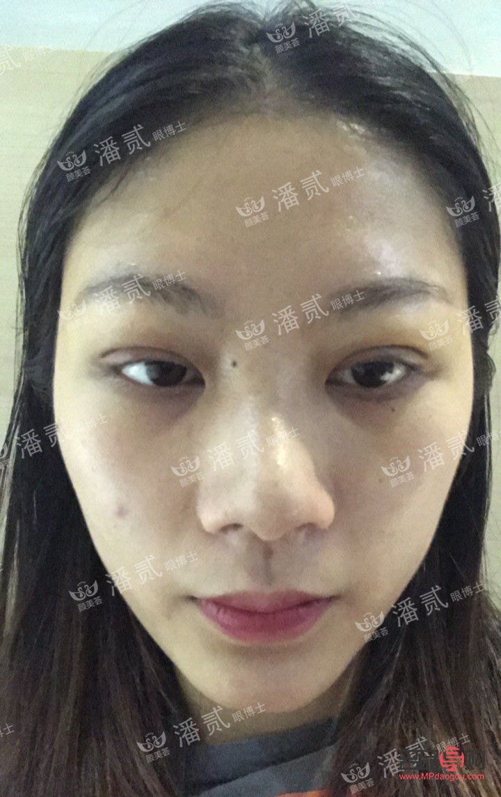 <h3>告別腫眼泡的秘訣與偏方</h3>